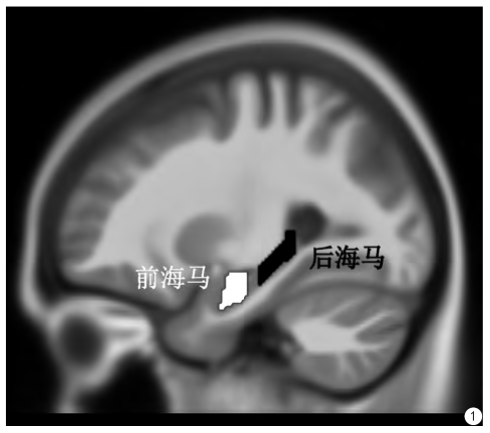 海马的分割来自于人脑自动解剖标记分区(automated anatomical